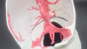 Anatomical white skull model cut open showing pink arteries and dark nasal cavity