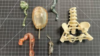Exploded Anatomical Model
